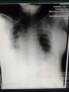 First X-ray